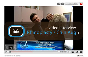rhinoplasty and chin augmentation video